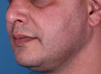 Large Pores
