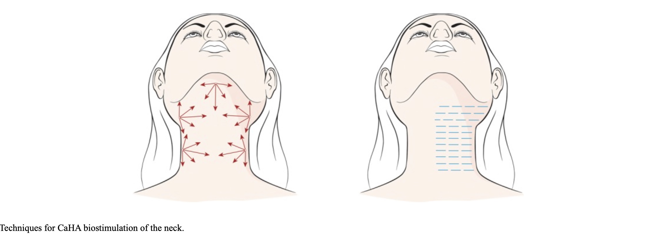 Techniques for CaHa biosimulation