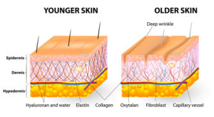 Skin Diagram of a younger skin compared to older skin, Laser Resurfacing, Scottsdale AZ
