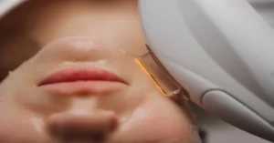 IPL BBL Photofacial treatment in Scottsdale targeting skin pigmentation and redness