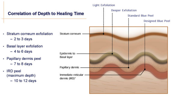 Skin Healing | ZO 3-Step Peel