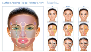 Surface Ageing Trigger Points