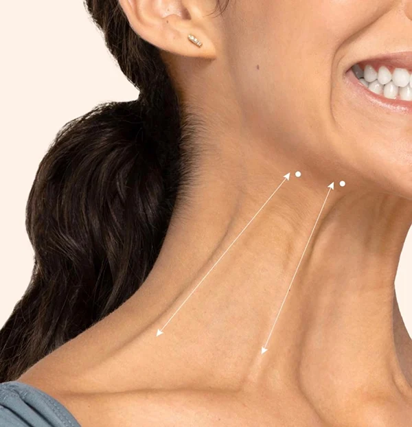 Botox neck bands Scottsdale