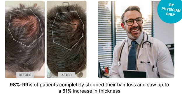 Before and after hair regrowth comparison alongside a smiling male physician wearing a stethoscope.