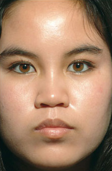 Patient 12 after photo of Obagi™ Systems patient at Sensational Skin Scottsdale