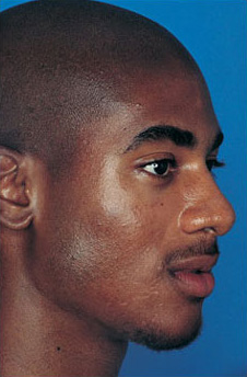Patient 13 after photo of Obagi™ Systems patient at Sensational Skin Scottsdale