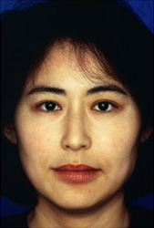 Patient 19 after photo of Obagi™ Systems patient at Sensational Skin Scottsdale