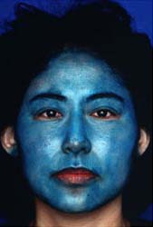 Patient 19 after photo of Obagi™ Systems patient at Sensational Skin Scottsdale