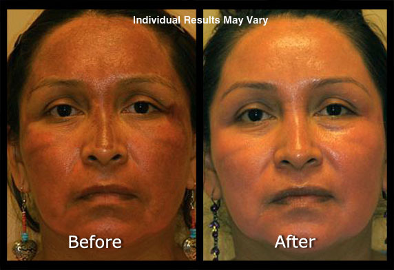 Medical Skin Care