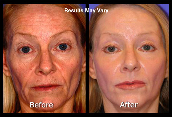 Active FX Laser Conveniently located to serve Scottsdale