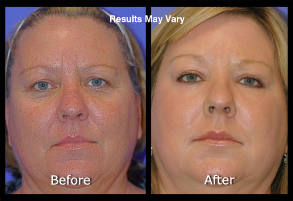 Active FX Laser Conveniently located to serve Scottsdale
