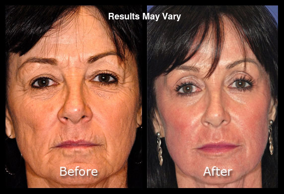 Active FX Laser Conveniently located to serve Scottsdale