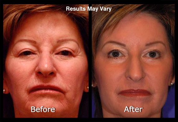 Active FX Laser Conveniently located to serve Scottsdale