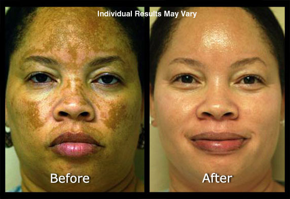 Medical Skin Care