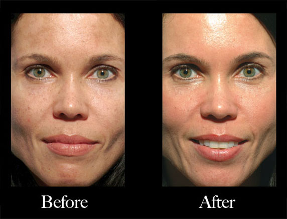 Obagi Nu-Derm Scottsdale