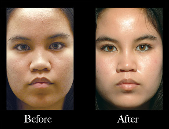Obagi Nu-Derm Scottsdale