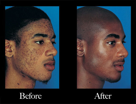 Obagi Nu-Derm Scottsdale