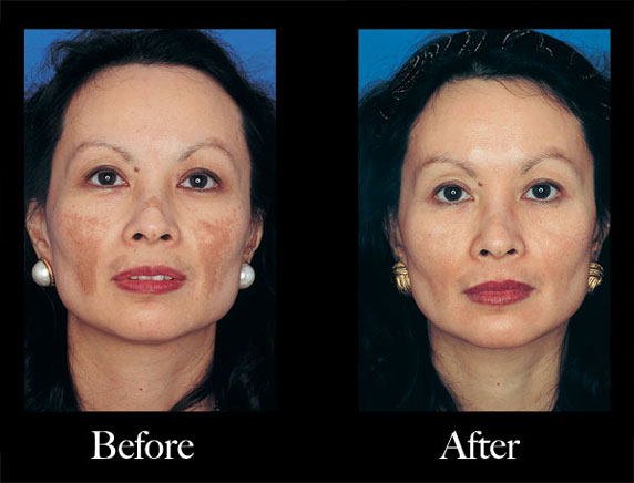Obagi Nu-Derm Scottsdale