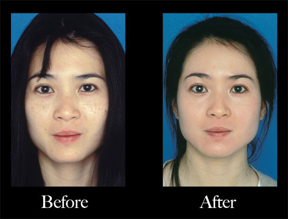 Obagi Nu-Derm Scottsdale