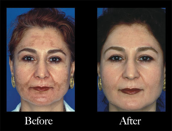 Obagi Nu-Derm Scottsdale