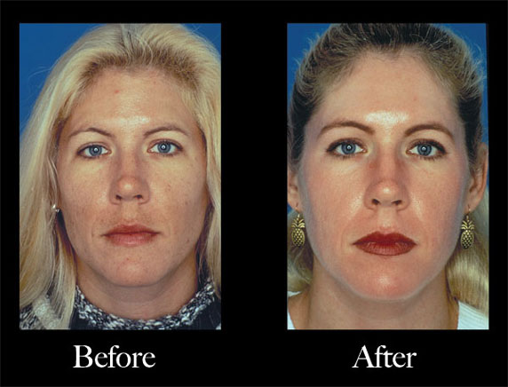 Obagi Nu-Derm Scottsdale