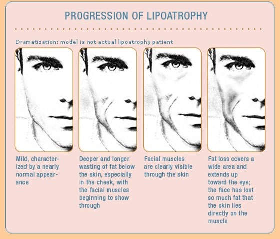 Facial Fillers & Injectables Scottsdale