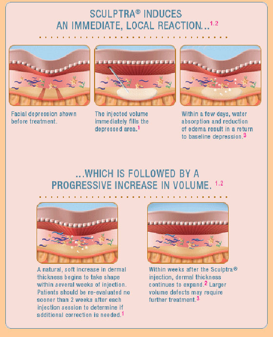 Facial Fillers & Injectables Scottsdale