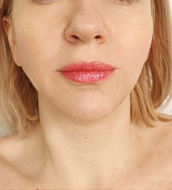 After image