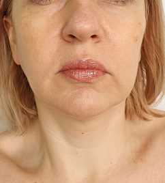 Before image