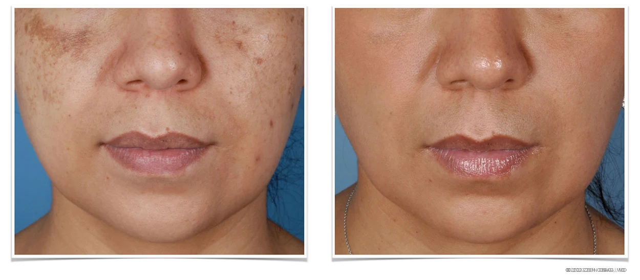 ZO Skin Health Scottsdale