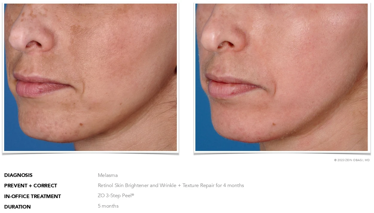 ZO Skin Health Scottsdale