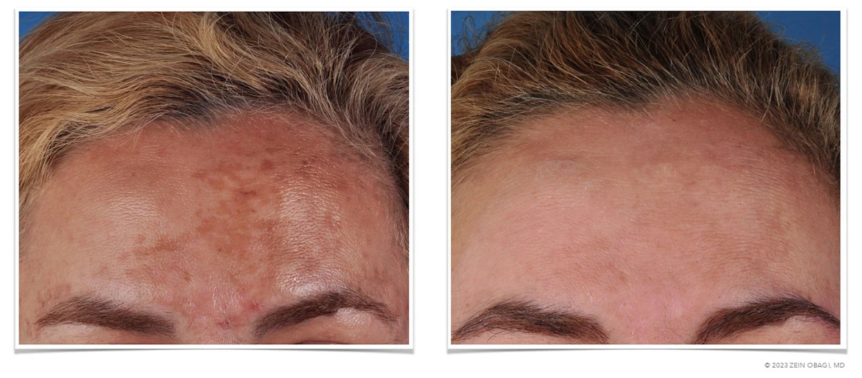 ZO Skin Health Scottsdale