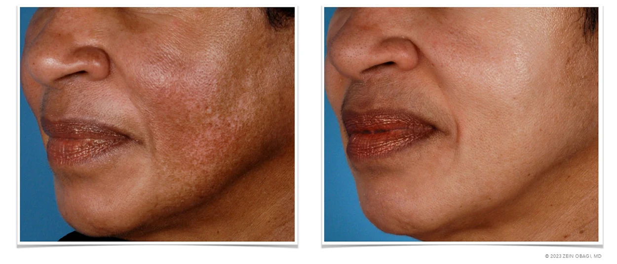 ZO Skin Health Scottsdale