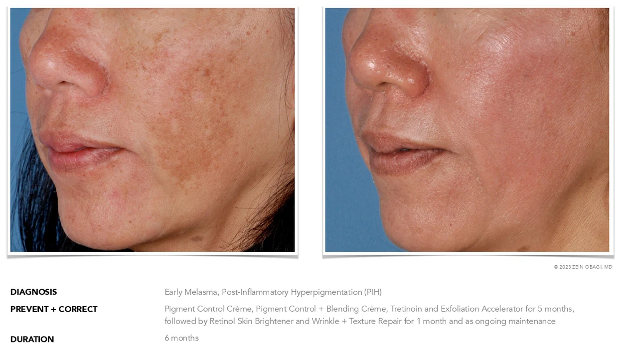 ZO Skin Health Scottsdale