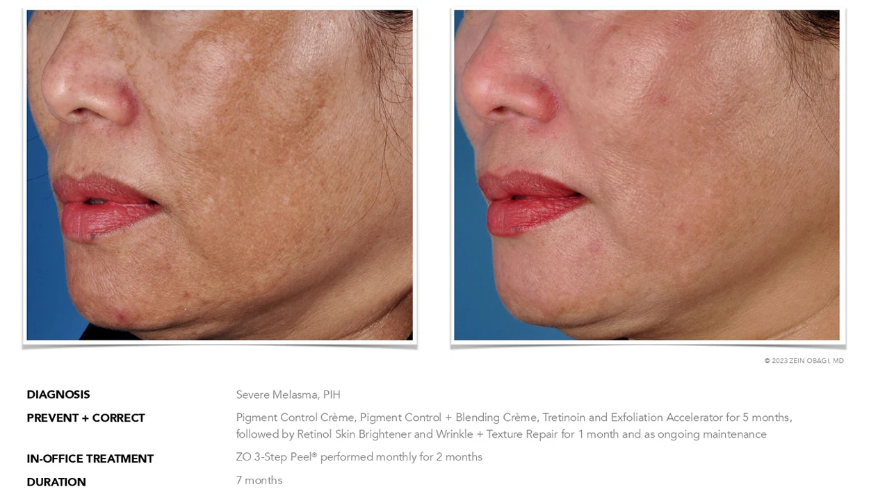 ZO Skin Health Scottsdale