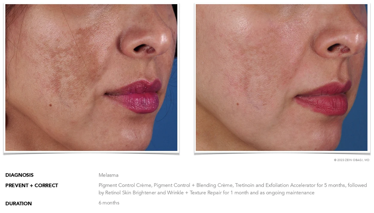 ZO Skin Health Scottsdale