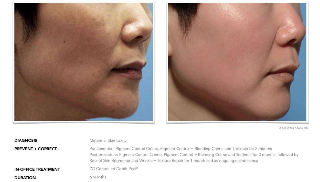 ZO Skin Health Scottsdale