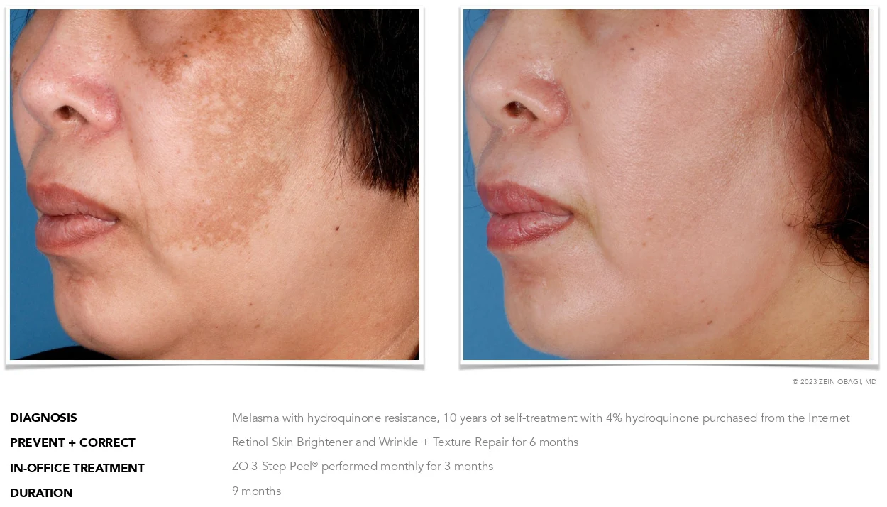 ZO Skin Health Scottsdale