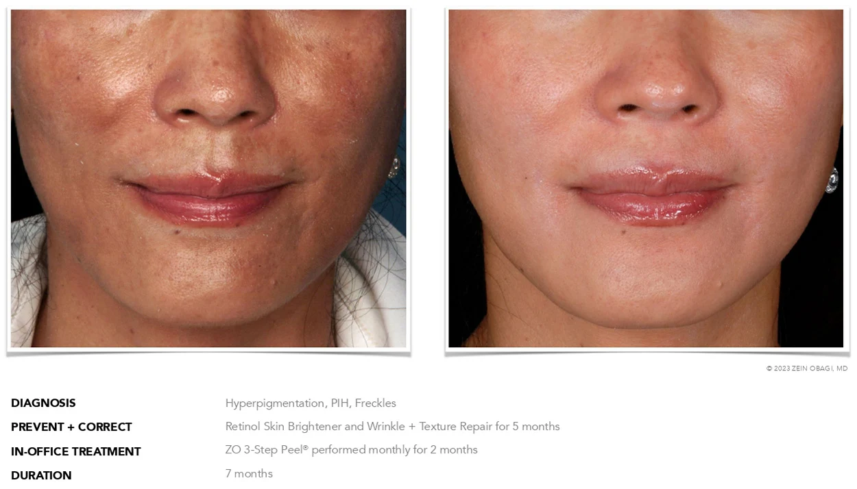 ZO Skin Health Scottsdale